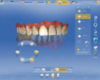 CEREC AC OMNICAM ПРОСТОЕ СКАНИРОВАНИЕ БЕЗ АНТИБЛИКОВОГО СПРЕЯ 15.jpg CEREC AC OMNICAM ПРОСТОЕ СКАНИРОВАНИЕ БЕЗ АНТИБЛИКОВОГО СПРЕЯ 15.jpg