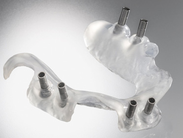 surgical guide.jpg
